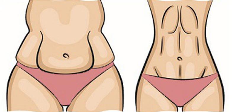 πώς να χάσετε το λίπος κάτω από την κοιλιά
